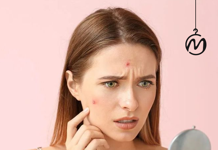چگونه از پوست چرب و جوش دار مراقبت کنیم؟ | ارائه 3 راهکار موثر